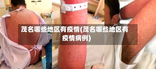 茂名哪些地区有疫情(茂名哪些地区有疫情病例)-第3张图片