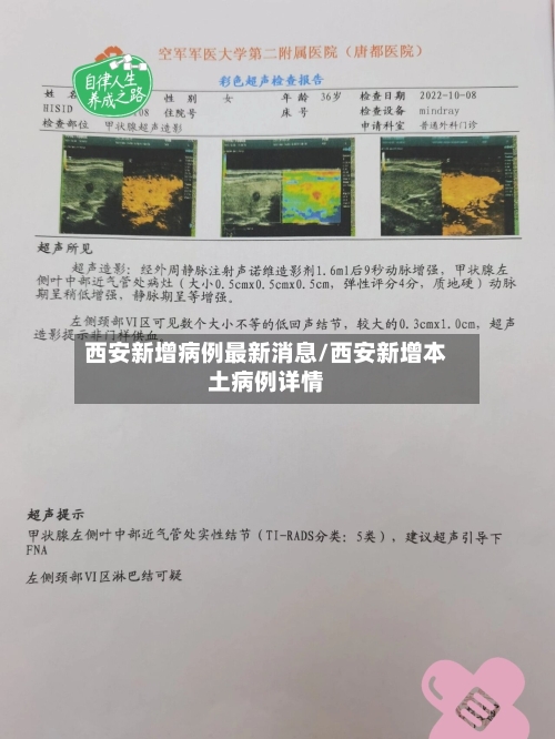 西安新增病例最新消息/西安新增本土病例详情-第2张图片