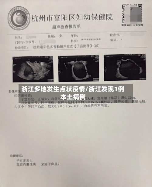 浙江多地发生点状疫情/浙江发现1例本土病例-第2张图片
