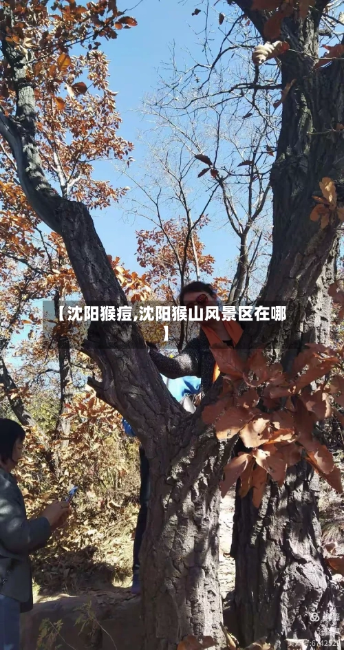【沈阳猴痘,沈阳猴山风景区在哪】