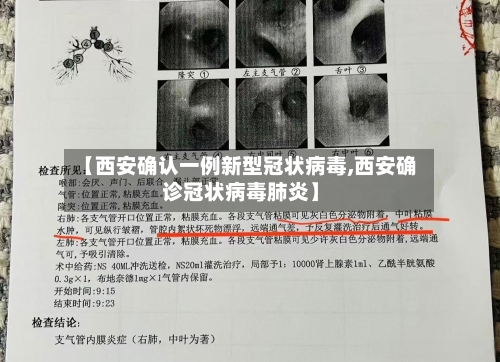 【西安确认一例新型冠状病毒,西安确诊冠状病毒肺炎】