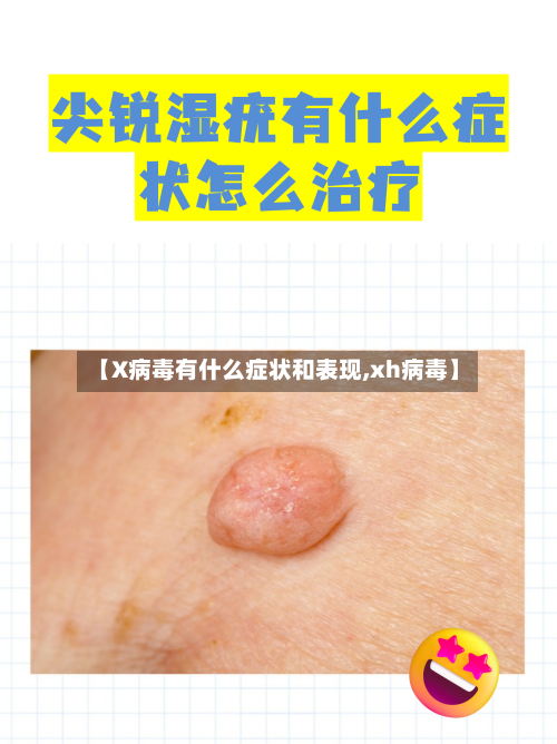 【X病毒有什么症状和表现,xh病毒】-第3张图片
