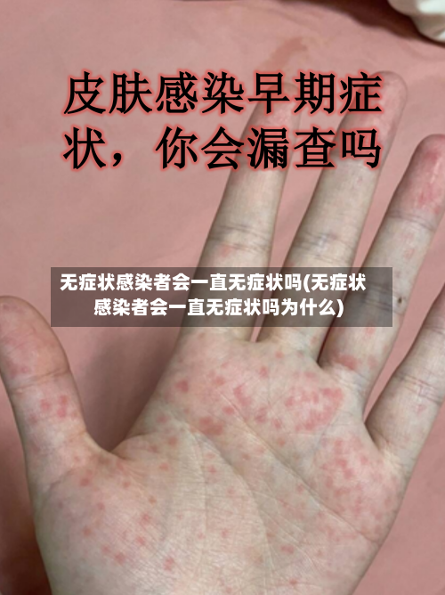 无症状感染者会一直无症状吗(无症状感染者会一直无症状吗为什么)