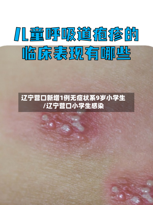 辽宁营口新增1例无症状系9岁小学生/辽宁营口小学生感染